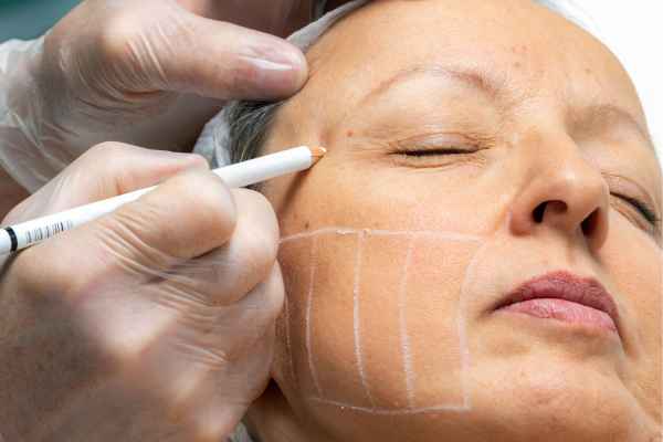 CryoPen: 5 Skin Concerns It May Be Used to Treat 4 What should you ask before having CryoPen treatment Oxted?